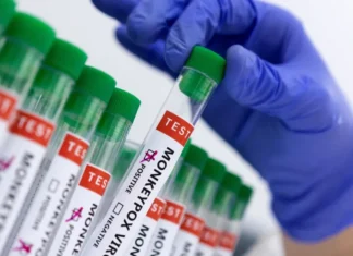 Mpox aumenta no Brasil e reacende alerta para monitoramento e vigilância